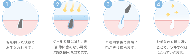 ミュゼ 背中脱毛